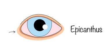 Epicanthus. A small piece of skin that covers the tear duct and runs from the bridge of the nose to the upper eyelid. A hand-drawn eye with the lacrimal tubercle covered by a fold of skin. Vector. clipart