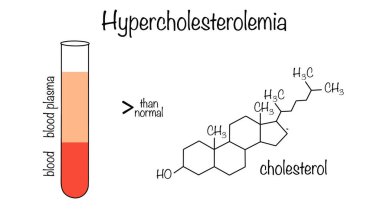 Hiperkolesterolemi. Kan plazmasında artan toplam kolesterol konsantrasyonuna karşı gelişen patolojik bir durum. Beyaz arkaplanda izole edilmiş vektör.