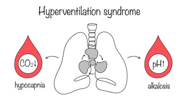 Hiperventilasyon sendromu. Hızlı nefes alma durumu, akciğerlerin havalandırılmasında anormal bir artışa ve kanın asit bazlı dengesinin bozulmasına yol açıyor. Vektör illüstrasyonu.