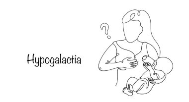 Hipogalactia. Emziren bir kadının göğüslerinin çok az süt ürettiği patolojik bir durum. Bir anne anne anne sütü eksikliğinden dolayı bebek maması ile beslenir. Vektör.