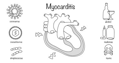 Myocarditis. Hand-drawn myocardial inflammation and the causes that can lead to this disease. Simple black and white illustration on a white background. clipart