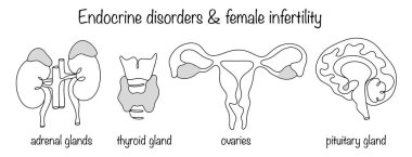 Kadın seks hormonları üreten kadın endokrin bezleri. Bu bezlerin düzgün çalışmaması hormonal dengesizliklere ve çocuk sahibi olma sorunlarına yol açar. Vektör illüstrasyonu.