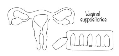 Vaginal suppositories. A vaginal suppository in the vagina and a package of medicine nearby. Treatment of gynecological diseases. Line drawn vector illustration.