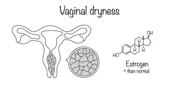 Vaginal dryness. Hand-drawn cracks inside the vagina as a symbol of severe dryness. The cause of this condition lies in low estrogen levels. Isolated vector on white background.