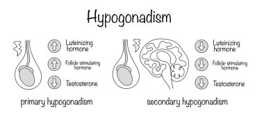 Hipogonadizm. Erkeklerde testis disfonksiyonu ya da hipofiz bezinin arızasına karşı gelişen patolojik bir durum. Hipogonadizmin elle çizilmiş diyagramı