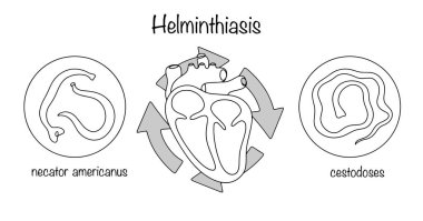 Helminantlar, insan vücuduna girerken dolaşım sistemine olumsuz etki eder. İnsan dolaşım sisteminin ana organı olarak el yapımı parazitler ve kalp. Vektör.