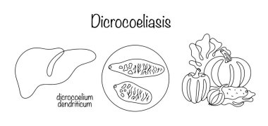 Dicrokoliyaz. Yıkanmamış sebze tüketiminden dolayı trematode sınıfındaki solucanların yol açtığı parazit bir hastalık. Karaciğer en çok hastalıktan etkilenir. Vektör tıbbi illüstrasyon.