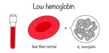 İçinde kan ve az miktarda hemoglobin bulunan kırmızı kan hücresi olan çizilmiş bir test tüpü. Vücudundaki demir eksikliğini gösteren düşük hemoglobin seviyesi anemi belirtisidir. Tıbbi vektör.