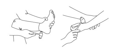 Bir nörolog hastanın kollarındaki ve bacaklarındaki tendon reflekslerini tıbbi çekiç kullanarak kontrol eder. Tıbbın teması üzerine siyah-beyaz çizimler. Vektör.