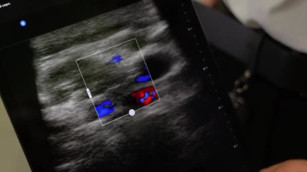 Diagnosi Dell Area Del Collo Con Uno Scanner Ultrasuoni Medico — Video Stock