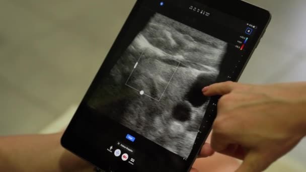 健康診断センターの医師による男性の体の超音波ソノグラム — ストック動画