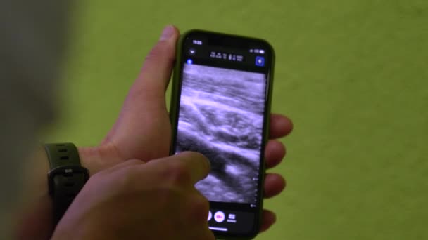 Врач Показывает Диагноз Пациента Рентгене Помощью Смартфона — стоковое видео