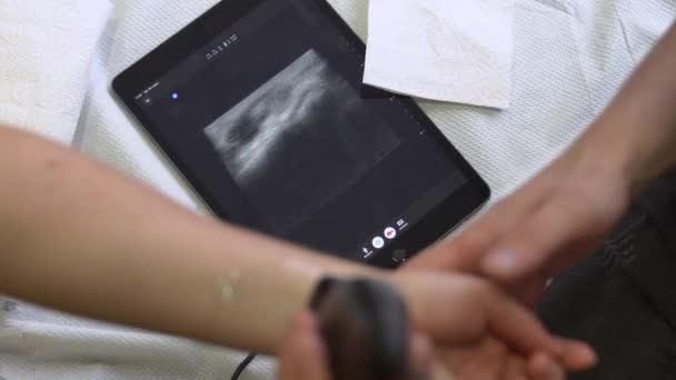 Лікарні Лікар Діагностує Руку Людини Портативною Рентгенівською Машиною Радіологія Аналізи — стокове відео
