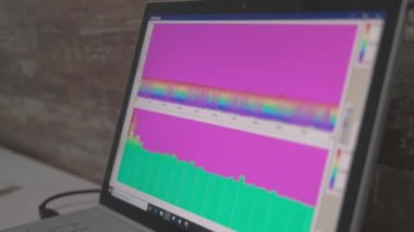 Ekranda çok renkli bir grafik var. Renkli parlak çizgiler, klinikteki modern ekipman okumaları