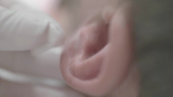 Médico Inserta Una Aguja Oído Del Paciente Primer Plano Medicina — Vídeo de stock