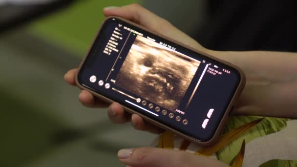 超声扫描对病人的计算机诊断 — 图库视频影像