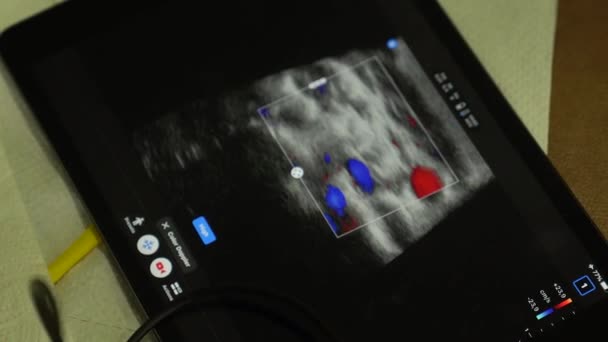 人体超声在临床 超声及超声检查中的应用 — 图库视频影像