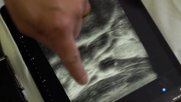 超声对人体的诊断 便携式X光扫描仪 — 图库视频影像