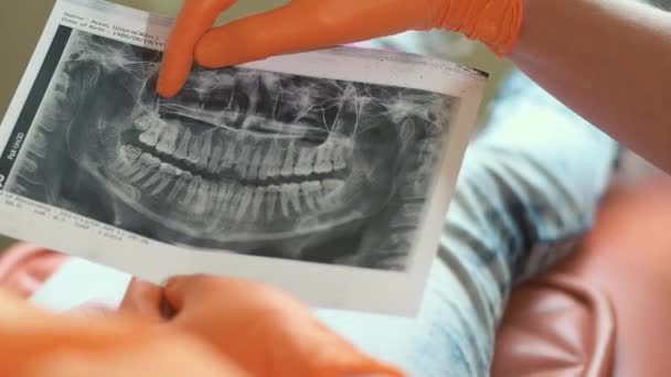 Zahnarzt Zeigt Einem Klienten Der Klinik Ein Röntgenbild Des Kiefers — Stockvideo