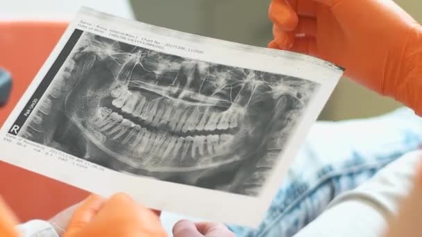 Dentista Trabaja Con Paciente Muestra Una Radiografía Mandíbula Con Los — Vídeo de stock