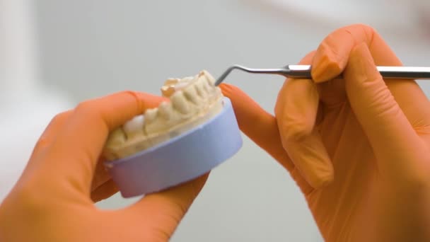 Lekarz Przygotowuje Sztuczną Szczękę Korony Dentystycznej Denture Sztuczny Ząb Protezy — Wideo stockowe