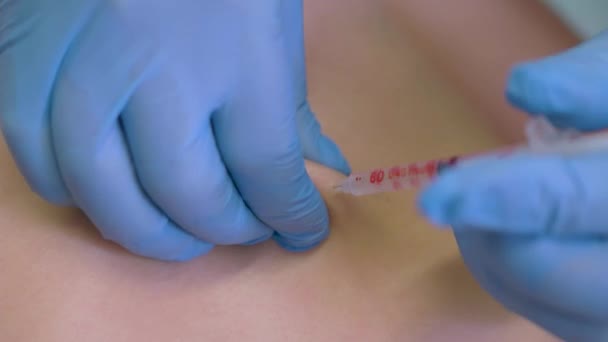 Doctor Gives Immunization Injection Patient Clinic Syringe Needle Close Enters — Stock Video