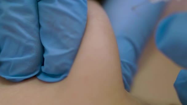Doctor Gives Injection Patient Clinic Vaccine Syringe Needle Entering Skin — Stock Video