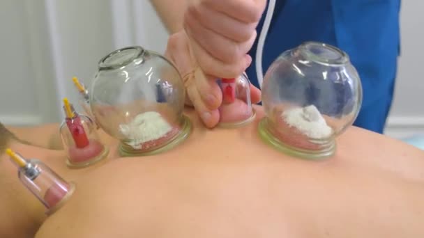 Jovem Está Receber Uma Massagem Nas Costas Massagista Coloca Copos — Vídeo de Stock