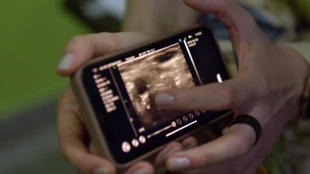 Raio Portátil Digitaliza Órgãos Paciente Uma Clínica Pesquisa Saúde Humana — Vídeo de Stock