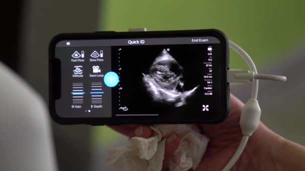腹部手持ち型超音波は患者の体を検査する 最先端のエコースキャナの医療センターでの試験 — ストック動画