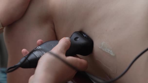 人体のポータブルX線スキャン ボディの診断 モニターの超音波出力 — ストック動画