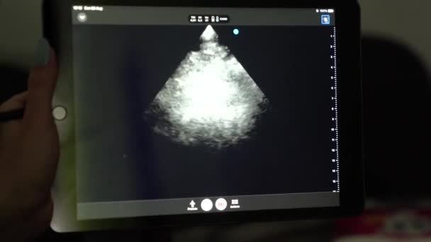 手术室监视器上的超声检查 内脏器官健康的计算机化诊断 — 图库视频影像