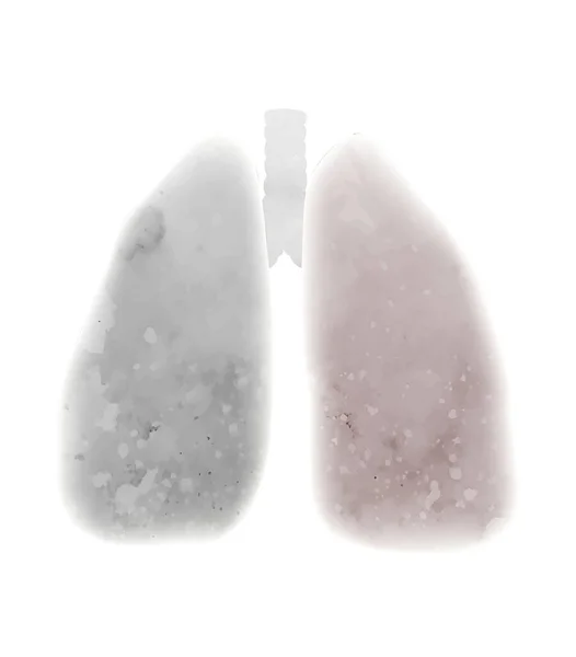 Διάνυσμα Υδατογραφία Απεικόνιση Των Προσβεβλημένων Πνευμόνων Καπνιστό Αναπνευστικό Σύστημα Σιλουέτα — Διανυσματικό Αρχείο