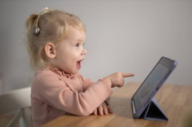 Cochlear implant system. Installation cochlear implant on child girl ear for restores hearing. Kid hears after hear return to normal.