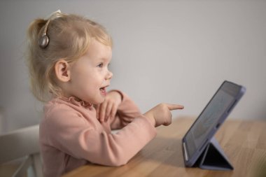 Cochlear implant system. Installation cochlear implant on child girl ear for restores hearing. Kid hears after hear return to normal.