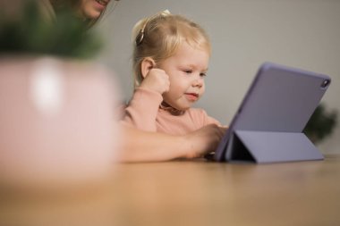 Funny baby with cochlear implant sitting at home and eating. Hear aid and medicine innovating technology and diversity concept