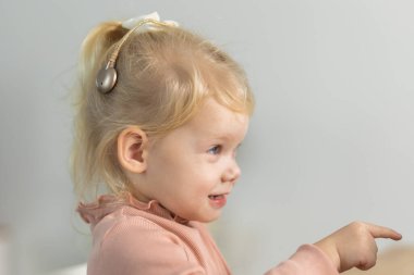 Funny baby with cochlear implant sitting at home and eating. Hear aid and medicine innovating technology and diversity concept