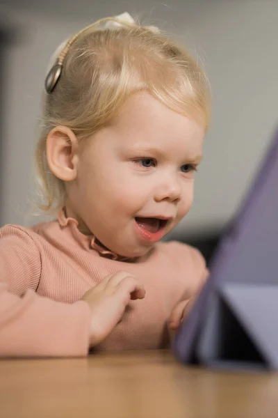 Funny Baby Cochlear Implant Sitting Home Eating Hear Aid Medicine — Fotografia de Stock
