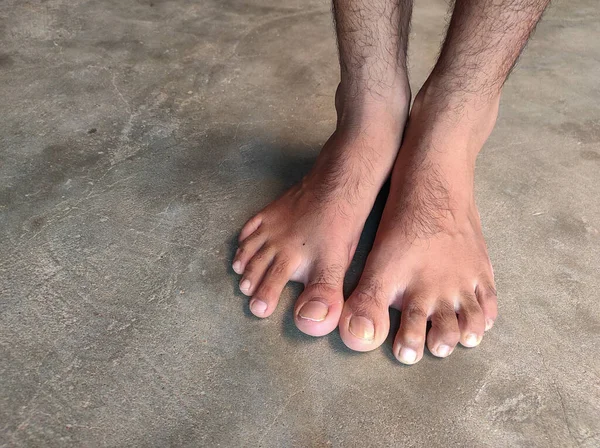 Egy Férfi Fiatal Láb Csupasz Férfi Körmök Indiai Falu Emberi — Stock Fotó