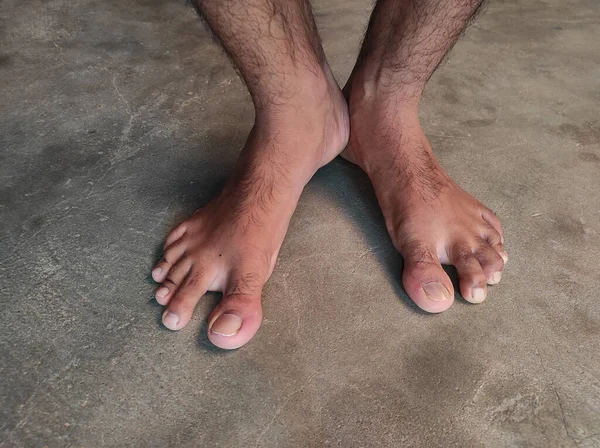 A Man Young Feet Bare, Male Fingernails, Indian Village Human Toenails, Hair, Skin, Foot,