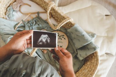 Ultrason fotoğrafı hamile bebek fotoğrafı. Ultrason görüntüsü taşıyan bir kadın. Hamilelik kavramı, annelik, bebek doğumu beklentisi.