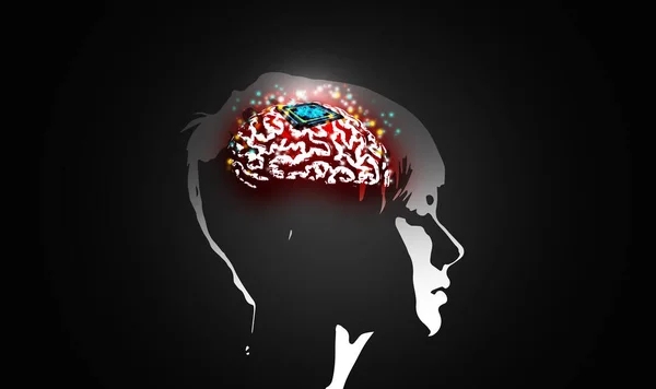 Mikročip Implantován Lidského Mozku Nervové Implantáty Mozkovo Počítačové Rozhraní Technologický — Stock fotografie