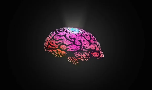 Microchip is implanted in human brain. Neural implants. Brain-computer interface. Neuron technology concept - illustration