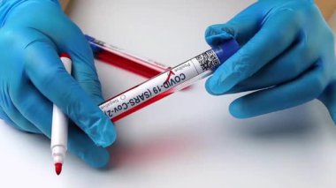 flasks with blood tests for coronavirus positive and negative, mpox