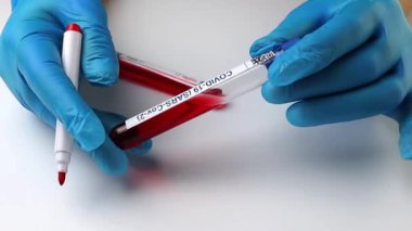 flasks with blood tests for coronavirus positive and negative, mpox
