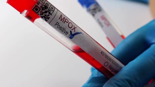 Flasks Blood Tests Coronavirus Positive Negative Mpox — Vídeo de stock
