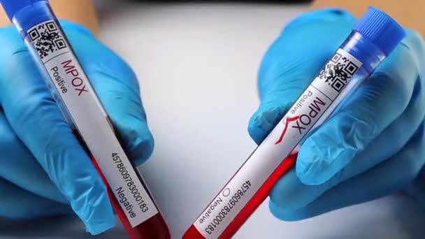 Flasks Blood Tests Coronavirus Positive Negative Mpox — Stock videók