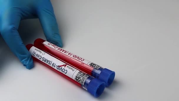 Flasks Blood Tests Coronavirus Positive Negative Mpox — Video