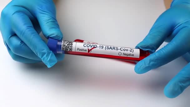Колби Аналізами Крові Коронавірус Позитивні Негативні Білок — стокове відео