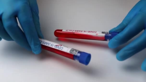 Flasks Blood Tests Coronavirus Positive Negative Mpox — Stockvideo